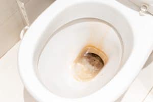 Dirty toilet bowl